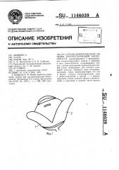 Способ хирургического лечения прогрессирующей близорукости (патент 1146039)