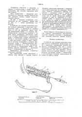Устройство для лечения переломов нижней челюсти (патент 1560178)
