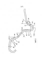 Торцевая крышка банки для напитка, имеющая дугообразную стенку панели и изогнутую переходную стенку (патент 2655906)