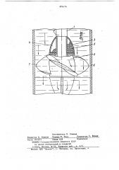 Механический аэратор флотационной машины (патент 876174)