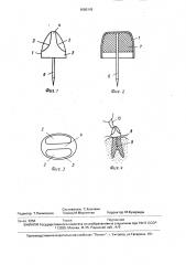 Зубной протез (патент 1680143)