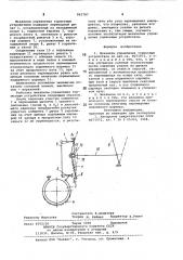 Механизм управления тормозным устройством (патент 861787)