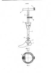 Протез бедра (патент 1442209)