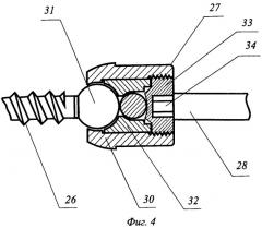 Способ имплантации протеза межпозвонкового диска и устройство для его осуществления (патент 2325861)
