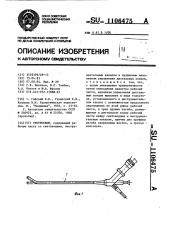 Уретероскоп (патент 1106475)