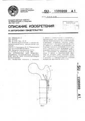 Устройство для компрессионного остеосинтеза бедренной кости при коррегирующих остеотомиях (патент 1598989)