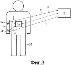Контроль жизненно важных параметров пациента с использованием нательной сенсорной сети (патент 2527355)