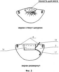 Защитный комплект для головы (патент 2392576)