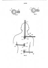 Устройство для фиксации позвоночника (патент 441932)