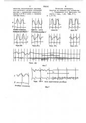 Способ моделирования фибрилляции желудочков сердца крысы (патент 893205)