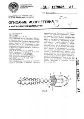 Эндопротез (патент 1279628)