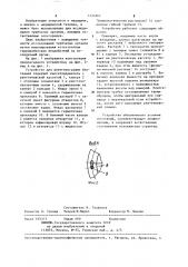 Устройство для рентгенографии биотканей (патент 1251867)