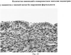 Способ диагностирования нарушения рецептивности эндометрия у пациенток с миомой матки и бесплодием (патент 2553340)