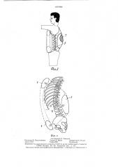 Корсет (патент 1377089)