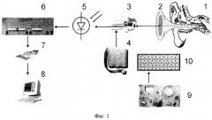 Способ измерения амплитуды колебаний барабанной перепонки (патент 2258462)