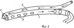 Универсальный комбинированный хирургический дренаж (патент 2292922)