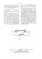 Ортопедический корсет (патент 1171028)