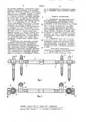Устройство для фиксации костныхфрагментов (патент 848012)
