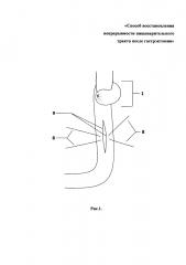 Способ восстановления непрерывности пищеварительного тракта после гастрэктомии (патент 2655980)