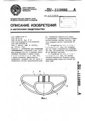 Устройство для тренировки горнолыжников (патент 1110460)