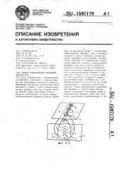 Способ формирования временной энтеростомы (патент 1597179)