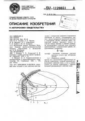 Земляная плотина (патент 1126651)