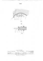 Ортодонтический аппарат (патент 293598)