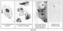 Способ окрашивания биологических материалов для микроскопических исследований (патент 2281472)