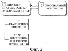 Способ неинвазивного электрофизиологического исследования сердца (патент 2409313)