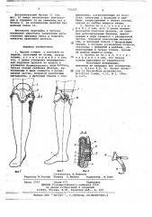 Протез голени с глубокой посадкой (патент 735252)