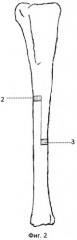 Способ моделирования переломо-дефекта длинной трубчатой кости (патент 2531441)