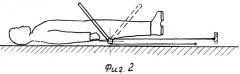 Устройство для подъема и укладки груза (патент 2363439)