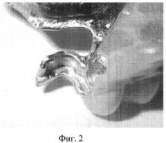Способ восстановления ретенционных свойств зубных протезов (патент 2463992)