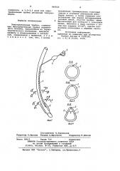 Эндотрахеальная трубка (патент 963523)