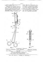 Зажим хирургический для поджелудочной железы при ее поперечной резекции лучом лазера (патент 1109147)