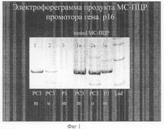 Способ диагностики онкологических заболеваний (патент 2245551)