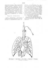 Способ формирования трансплантата сердца-легкие (патент 694183)