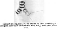 Способ герметизации культи бронха (патент 2310397)