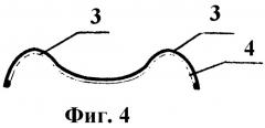 Индивидуальная ложка куретовых для снятия оттиска на беззубую челюсть (два варианта) (патент 2481804)