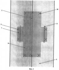 Способ пластики грыж передней брюшной стенки (патент 2452399)