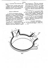 Способ изготовления протеза сердечного насоса (патент 921570)