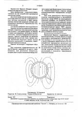 Магнитный браслет (патент 1710072)