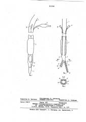 Интубационная трубка (патент 812296)