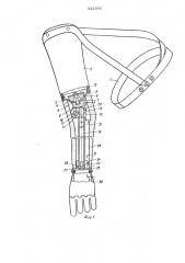 Функционально-косметический протез плеча (патент 543396)