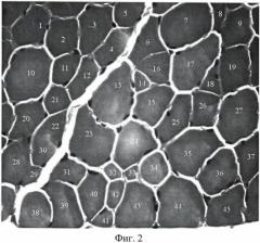 Способ количественной оценки нейрогенных изменений волокон скелетных мышц (патент 2483305)