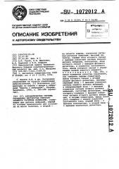 Автоматическая система управления жесткостью упругого элемента гасителя колебаний (патент 1072012)