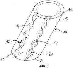 Трубка для энтерального питания (патент 2463009)