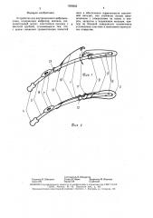 Устройство для внутриносового вибромассажа (патент 1560205)