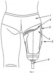 Протез с ложем для размещения ампутационной культи (патент 2444335)