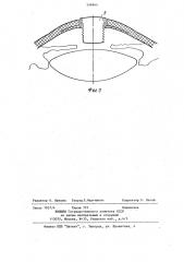 Протез роговицы (патент 506964)
